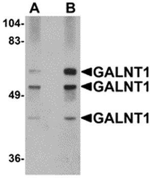 GALNT10 Antibody