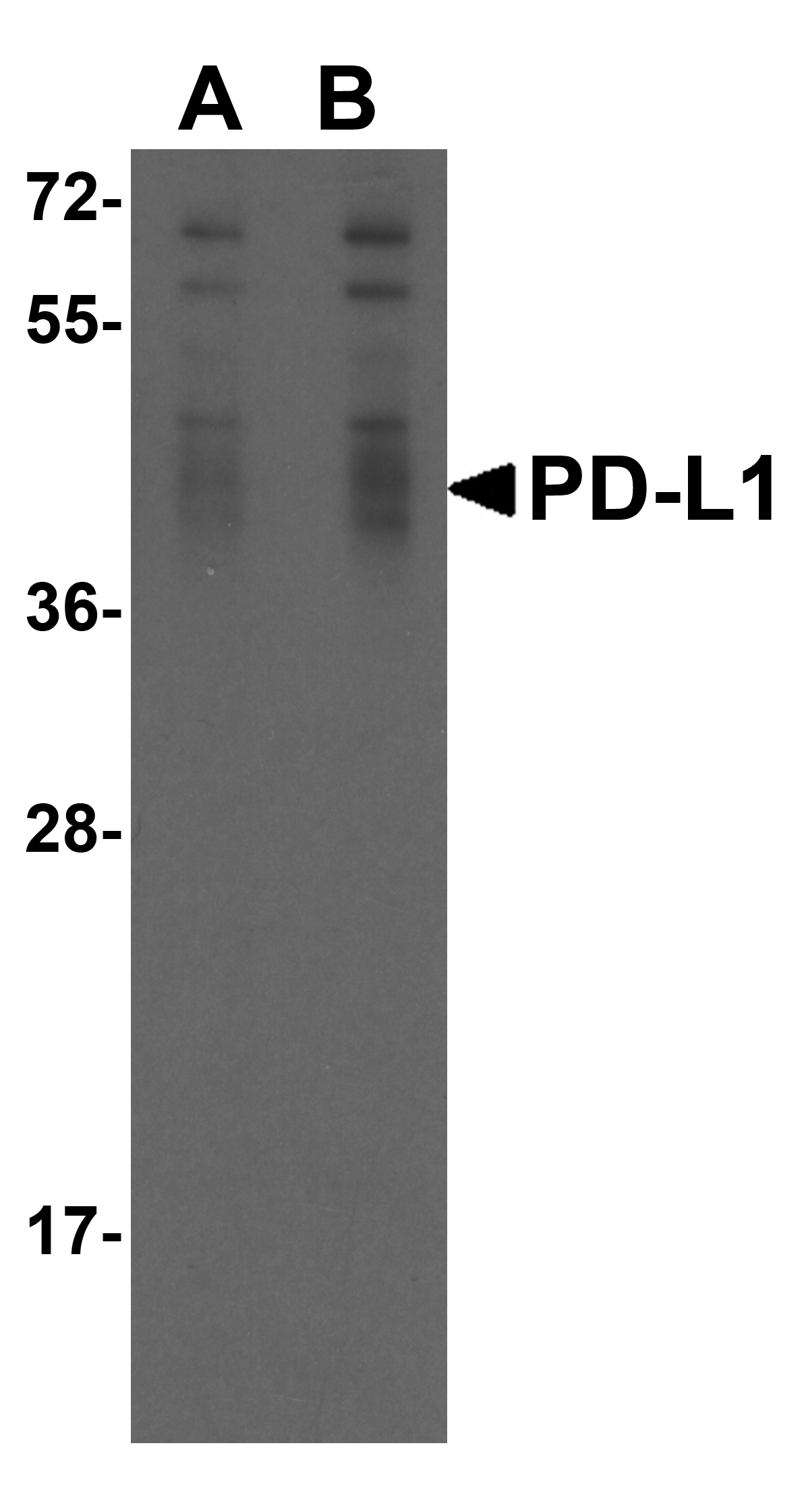 CD274 Antibody