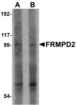 FRMPD2 Antibody