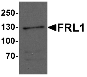 FMNL1 Antibody