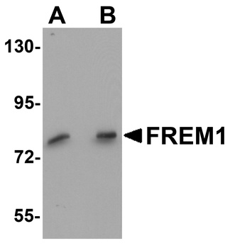 FREM1 Antibody