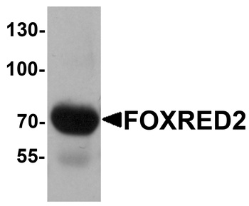 FOXRED2 Antibody