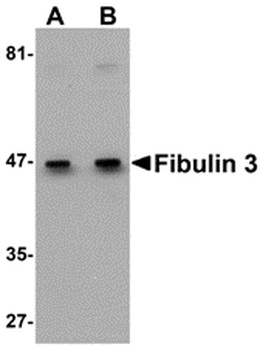 EFEMP1 Antibody