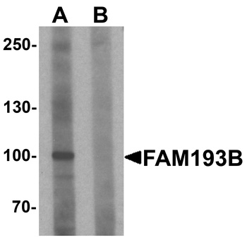 FAM193B Antibody