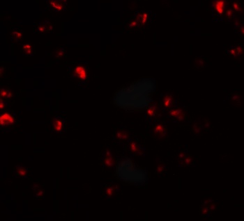 FAM193B Antibody