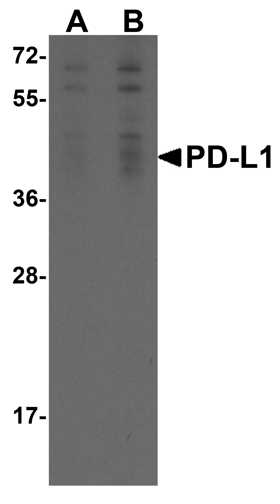 CD274 Antibody