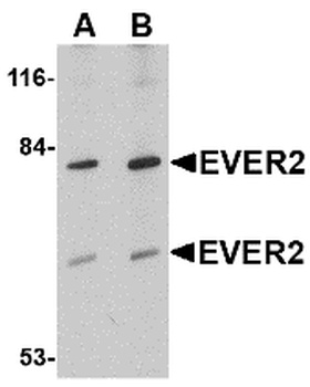 EVER2 Antibody