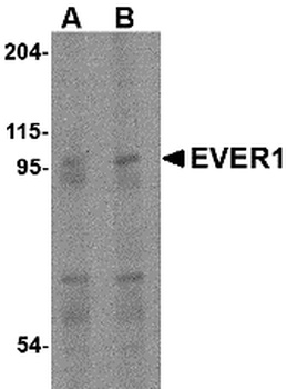 EVER1 Antibody