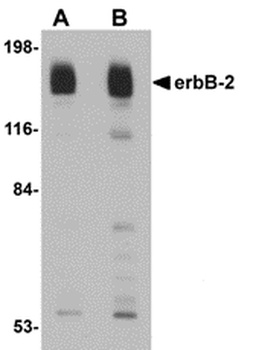 ERBB2 Antibody
