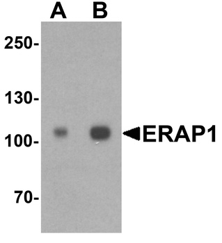 ERAP1 Antibody