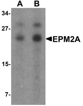 EPM2A Antibody