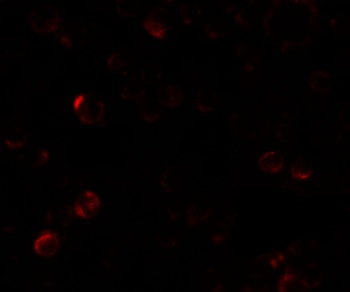 EPM2A Antibody