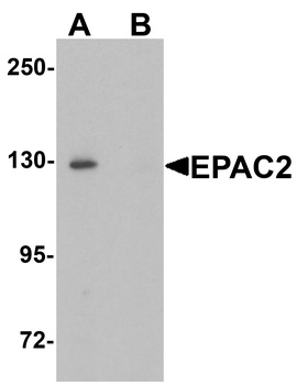 RAPGEF4 Antibody