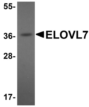 ELOVL7 Antibody