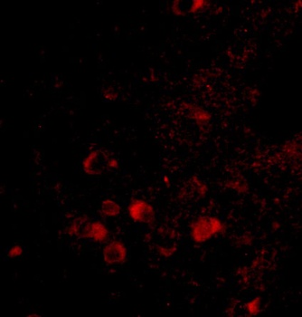 ELOVL6 Antibody