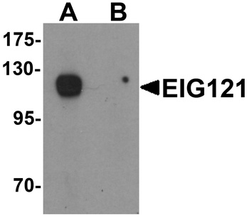 KIAA1324 Antibody