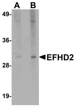 EFHD2 Antibody