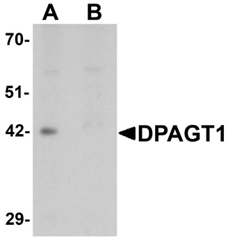 DPAGT1 Antibody
