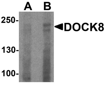 DOCK8 Antibody