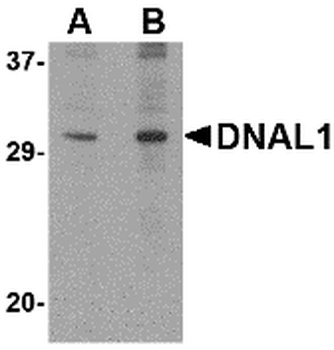 DNAL1 Antibody