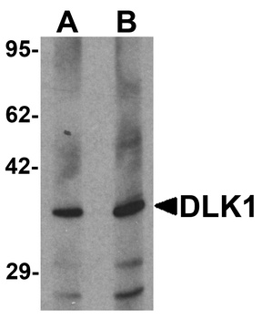 DLK1 Antibody