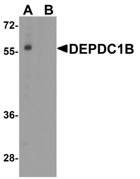 DEPDC1B Antibody