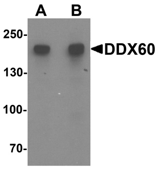 DDX60 Antibody