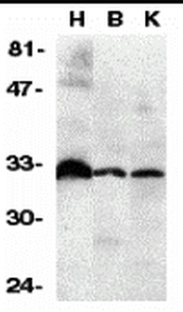 TNFRSF6B Antibody