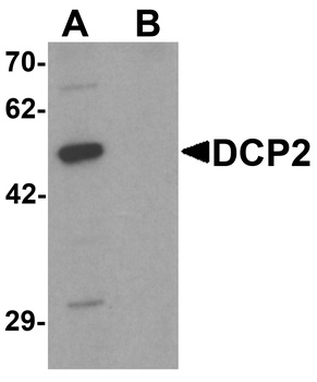 DCP2 Antibody