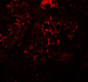 DCP2 Antibody