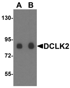 DCLK2 Antibody