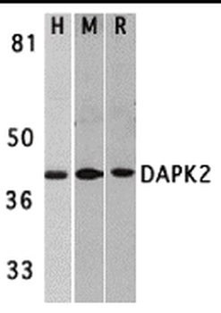 DAPK2 Antibody