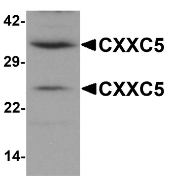 CXXC5 Antibody