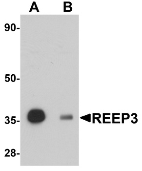 REEP3 Antibody