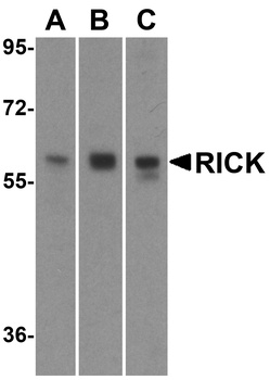 RIPK2 Antibody
