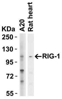 DDX58 Antibody