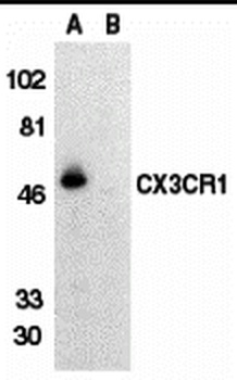 CX3CR1 Antibody