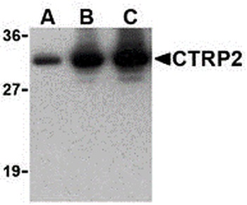 CTRP2 Antibody