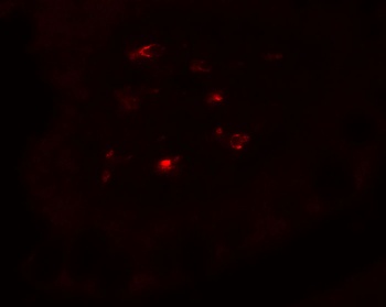CTHRC1 Antibody
