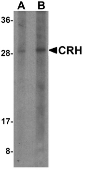 CRH Antibody