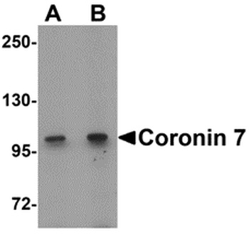 Coronin 7 Antibody