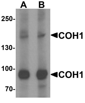 VPS13B Antibody