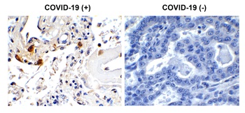 SARS-CoV-2 (COVID-19) Envelope Antibody