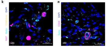 SARS-CoV-2 (COVID-19) Spike Antibody