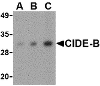 CIDEB Antibody