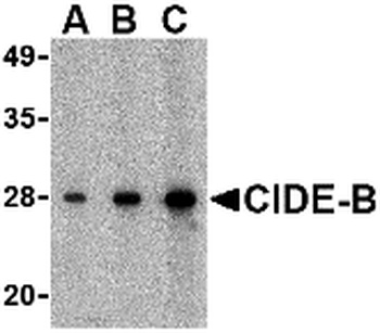 CIDEB Antibody