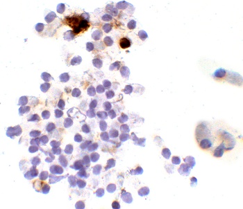 SARS-CoV-2 (COVID-19) Spike G142D Δ143-145VYY Antibody (Omicron)