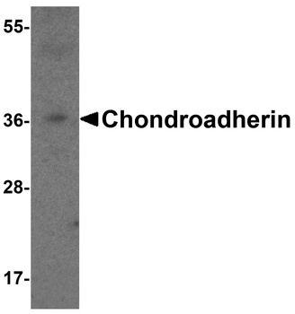 CHAD Antibody