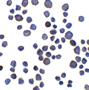 CHAD Antibody