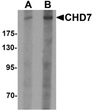 CHD7 Antibody